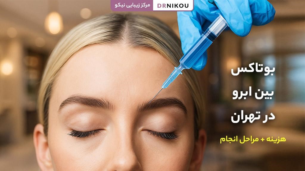 Botox between eyebrows in Tehran