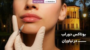 بوتاکس دور لب در نیاوران