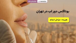 بوتاکس دور لب در تهران