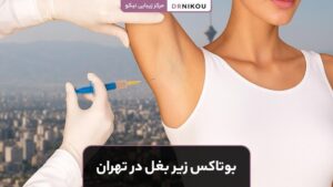 بوتاکس زیر بغل در تهران