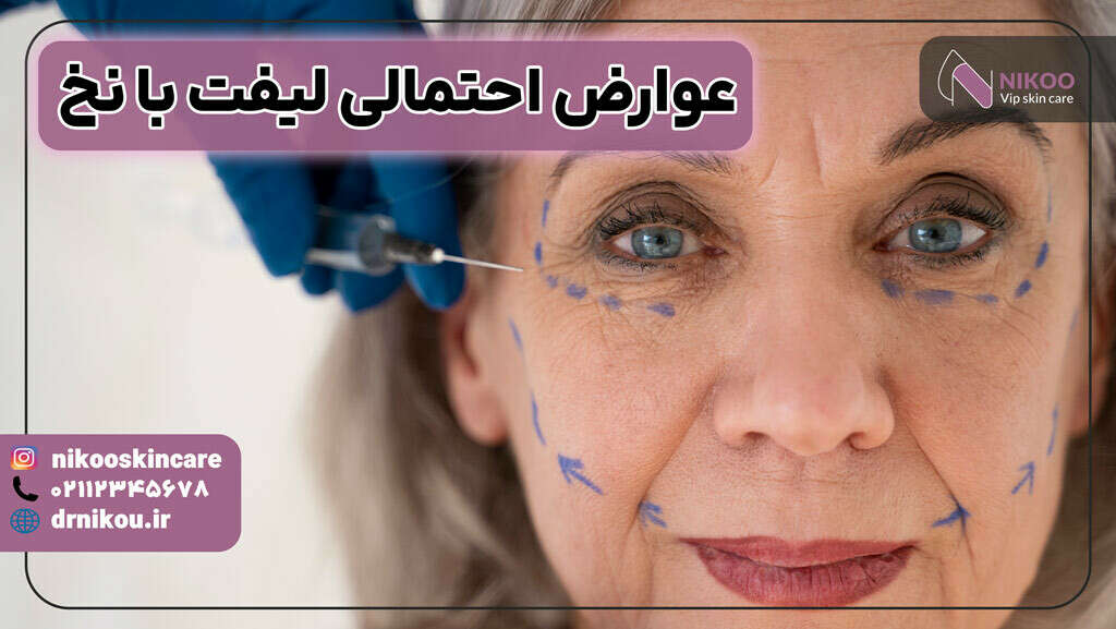 عوارض لیفت با نخ