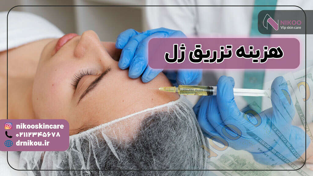 هزینه تزریق ژل