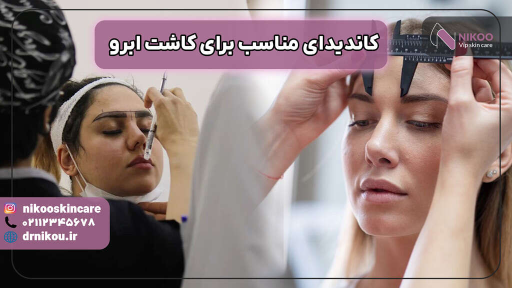 کاندیدای مناسب برای کاشت ابرو