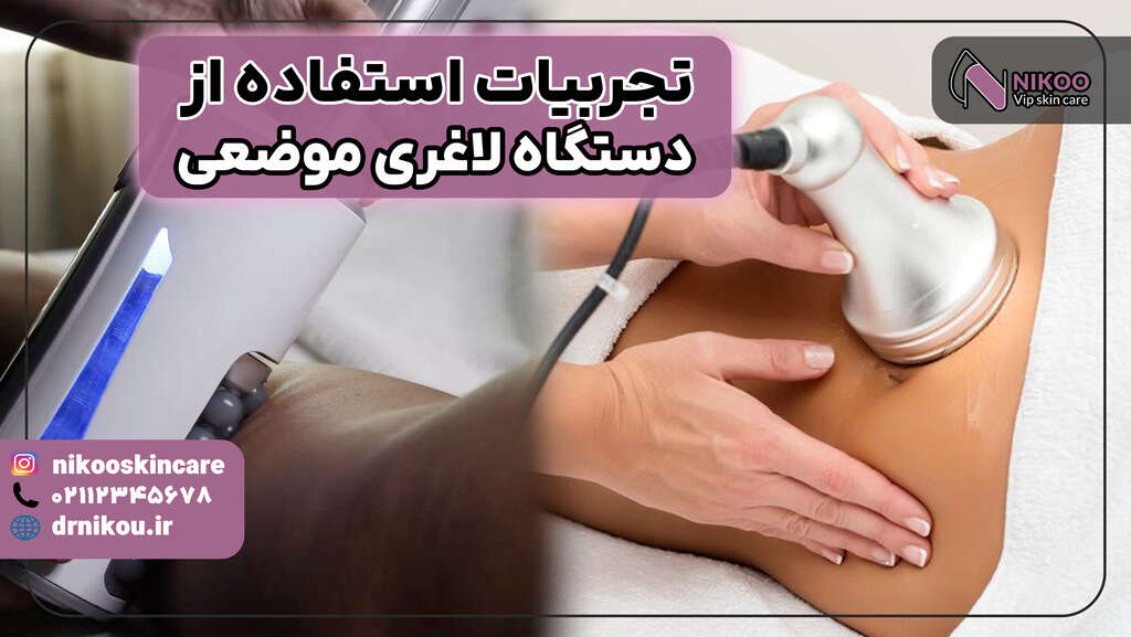 تجربیات استفاده از دستگاه لاغری موضعی