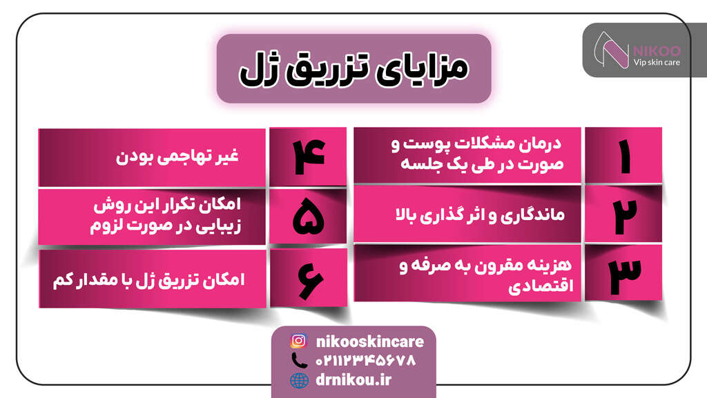 مزایای تزریق ژل 