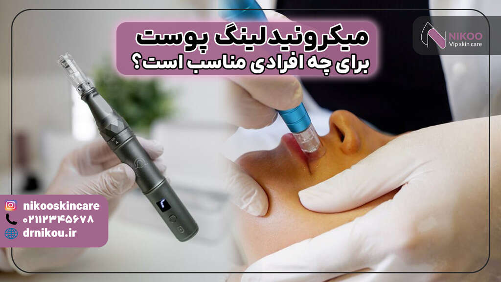 میکرونیدلینگ برای چه افرادی مناسب است؟