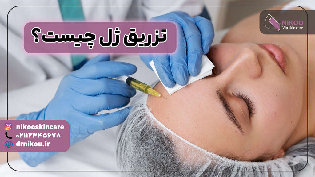 تزریق ژل چیست؟