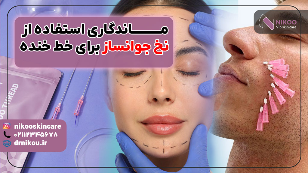ماندگاری نخ جوانساز برای رفع خط خنده