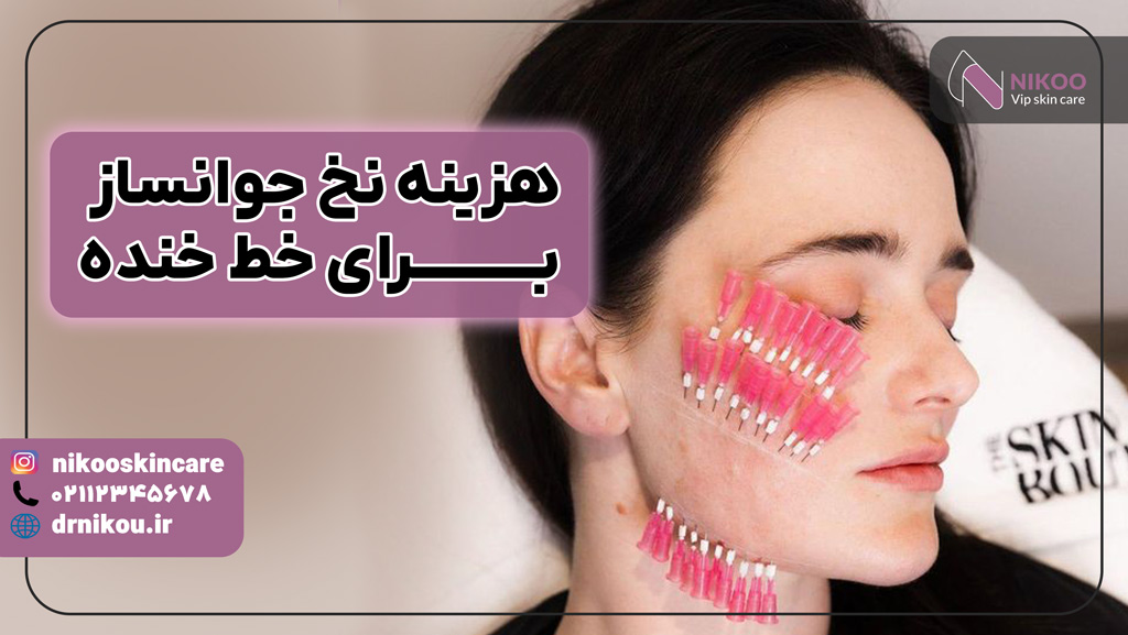 هزینه رفع خط خنده با نخ