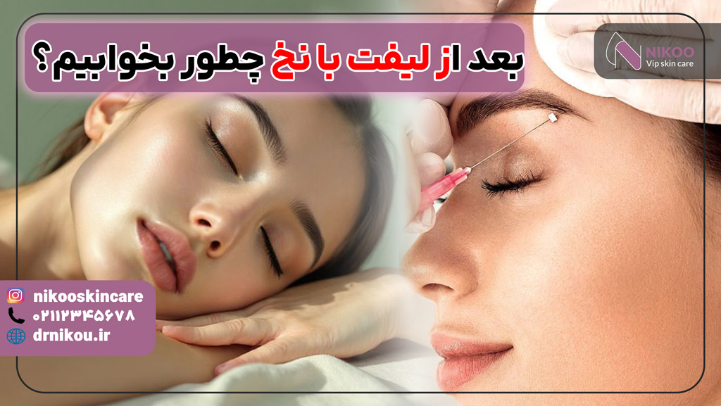 نحوه خوابیدن بعد از لیفت با نخ