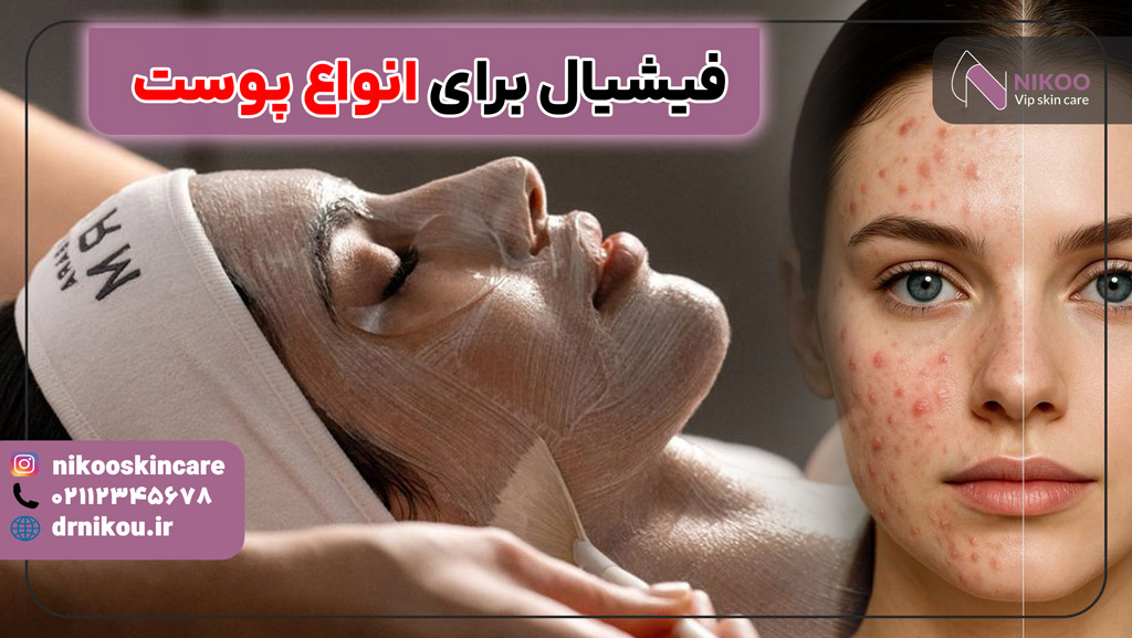 فیشیال برای انواع پوست