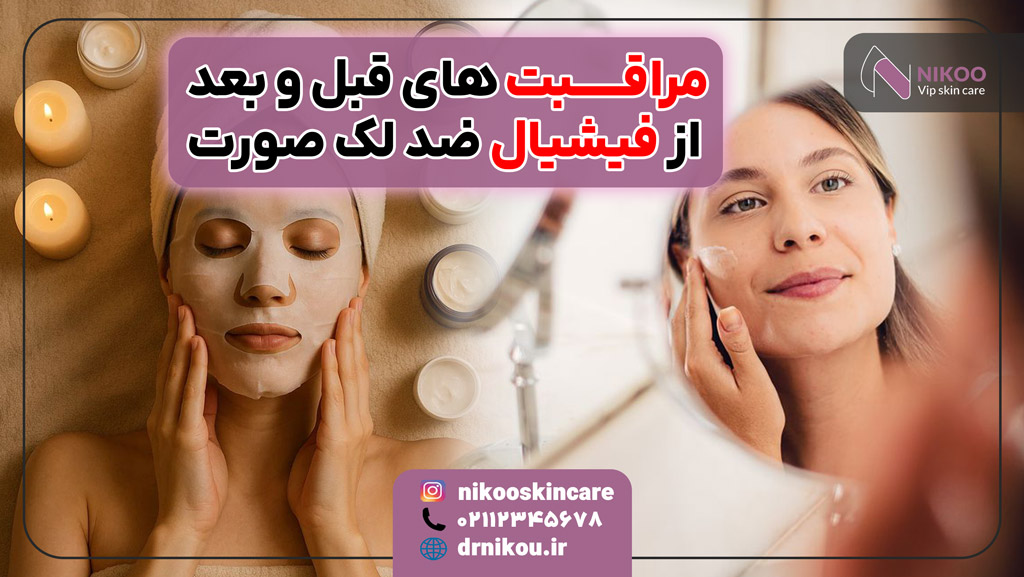 مراقبت های قبل و بعد از فیشیال ضد لک صورت