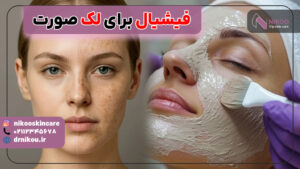 فیشیال برای لک صورت