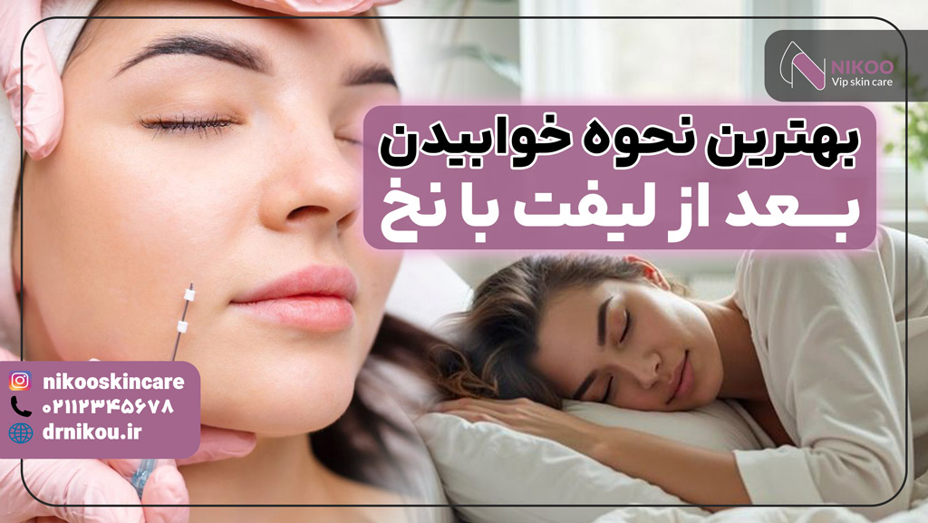 بهترین نحوه خوابیدن بعد از لیفت با نخ