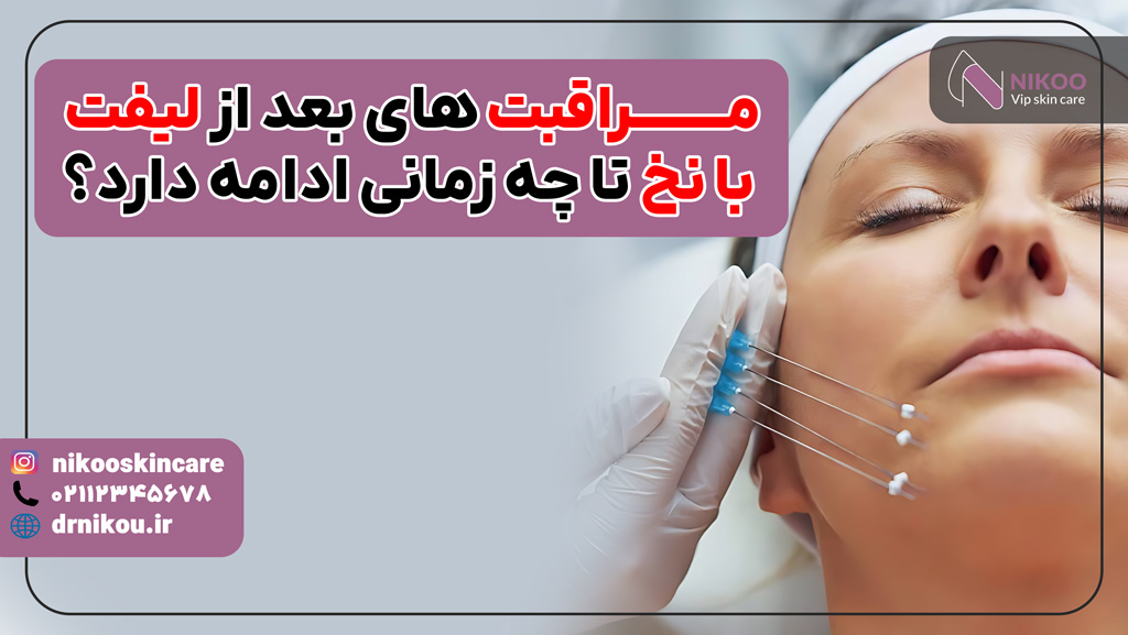 مراقبت های بعد از لیفت با نخ تا چه زمانی باید ادامه پیدا کند؟