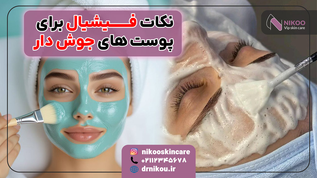نکات فیشیال برای پوست های جوش دار