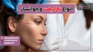 انواع نخ لیفت و جوانساز