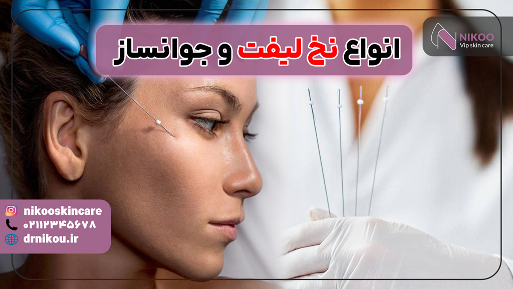 انواع نخ لیفت و جوانساز
